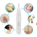 Caneta Laser Removedor de Verrugas Manchas Tatuagens Sardas - Divino Produto
