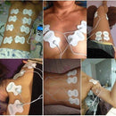 Aparelho Eletroestimulador - Fisioterapia e Acupuntura