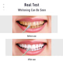 Caneta de Clareamento Dental - Whitening Kit - Divino Produto