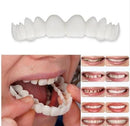 Facetas Odontológicas Removíveis - Próteses Superiores e Inferiores