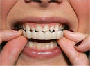 Facetas Odontológicas - SmileVeneers - Divino Produto