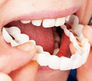 Facetas Odontológicas - SmileVeneers - Divino Produto