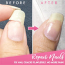 Gel Repara Unhas Rachadas - Nail Fixer - Divino Produto