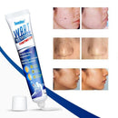 Remoção Instantânea de Manchas - Ultra Remover
