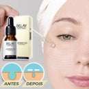 Zero Poro - Rejuvenescedor e Removedor de Rugas - Divino Produto